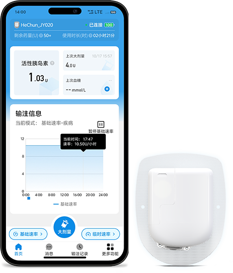 小和泵手机 APP 与无管路贴敷泵组合展示